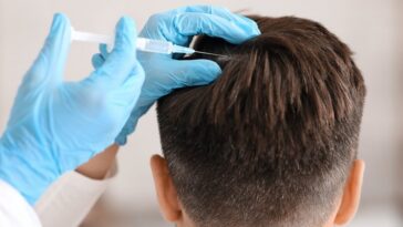 PRP Therapy for Afro Textured Hair Regrow Naturally