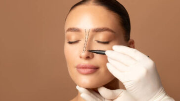 Rhinoplasty in Riyadh 10