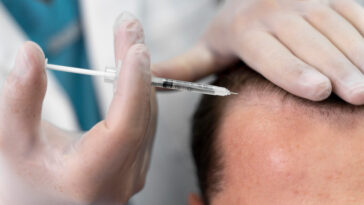 PRP Hair Treatment The Science of Regeneration