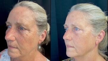 1603230304 0e86d0c4 cd31 42e3 b4cb 54b99b0c333d