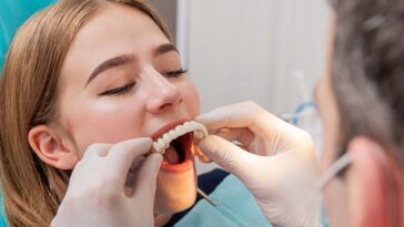 Full Mouth Dental Implants Cost in Dubai 9