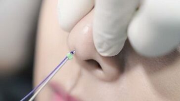 HikoNoseThreadLiftDubaiPrice