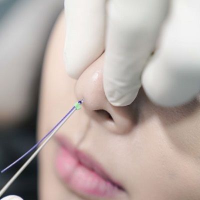 HikoNoseThreadLiftDubaiPrice