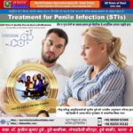 penile infection treatment dr sunil dubey