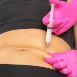 Is Laser Lipolysis the Best Non-Surgical Fat Fix? 21 Lipolysis 1