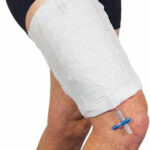 Urine Bag Market Industry Research and Demand, Share by 2032 20 Urine Bag Market