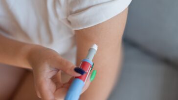 Ozempic and Hair Loss Is There a Connection