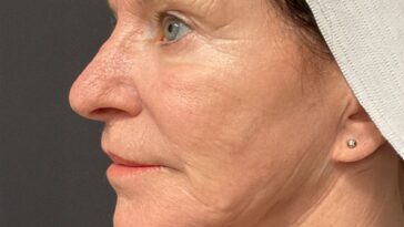 cheryl landi left morpheus Before