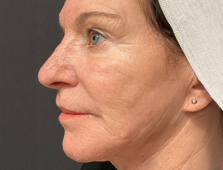 cheryl landi left morpheus Before