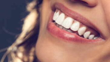 Teeth Whitening Cost in Dubai16 1