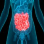 Carcinoid Syndrome Diarrhea Treatment Market 1