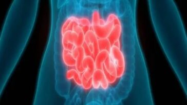 Carcinoid Syndrome Diarrhea Treatment Market 1