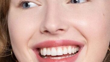 Teeth Whitening Cost in Dubai6 1