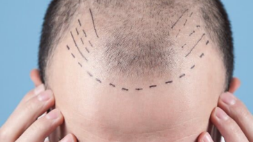 %D8%B2%D8%B1%D8%A7%D8%B9%D8%A9 %D8%A7%D9%84%D8%B4%D8%B9%D8%B1 %D9%81%D9%8A %D8%A7%D9%84%D8%B1%D9%8A%D8%A7%D8%B6 15