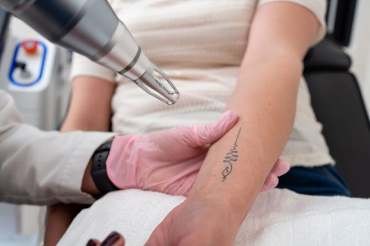 Erase It Like Magic – Next-Level Laser Tattoo Removal in Dubai! 1 GettyImages 2149444256 5122db382d8f443baf514896adaba1a8 1
