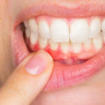 Best Teeth and Gum Care in Faridabad 21 TeethandGum2