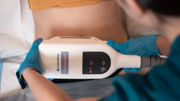 How CoolSculpting Can Help With Body Goal