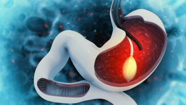 %D8%B9%D9%85%D9%84%D9%8A%D8%A9 %D8%A8%D8%A7%D9%84%D9%88%D9%86 %D8%A7%D9%84%D9%85%D8%B9%D8%AF%D8%A9 %D9%81%D9%8A %D8%A7%D9%84%D8%B1%D9%8A%D8%A7%D8%B6 4