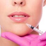 Elegant Enhancements: Timeless Lip Filler Styles 20 Elegant Enhancements Timeless Lip Filler Styles