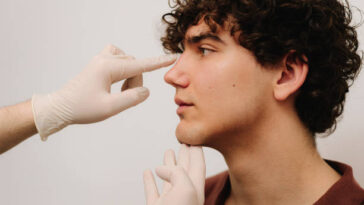 Nose tip plasty in Riyadh 10