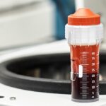 How Stem Cell Therapy Boosts Healing Speed? 21 press release experimental stem cell therapy speeds up wound healing diabetes