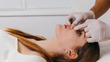 Rhinoplasty surgery in Riyadh 24