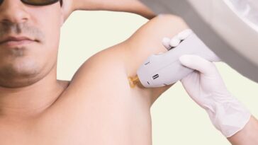 Let Your Skin BreatheChoose Laser Hair Remova