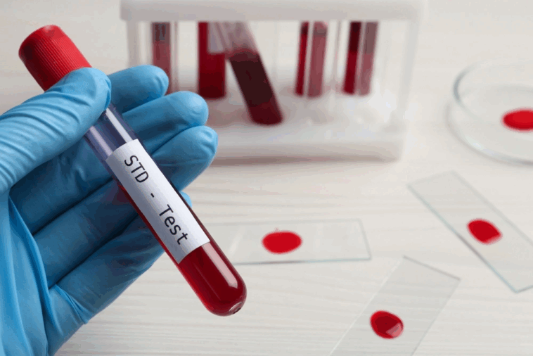 Take the Inclusive Approach with STD Test in Dubai 1 std test