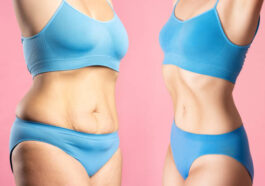 %D8%B4%D9%81%D8%B7 %D8%A7%D9%84%D8%AF%D9%87%D9%88%D9%86 %D9%81%D9%8A %D8%A7%D9%84%D8%B1%D9%8A%D8%A7%D8%B6 8 1