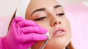 Lip Filler Injections A Quick and Easy Way to Get Gorgeous Lip