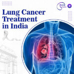 Lung Cancer 1