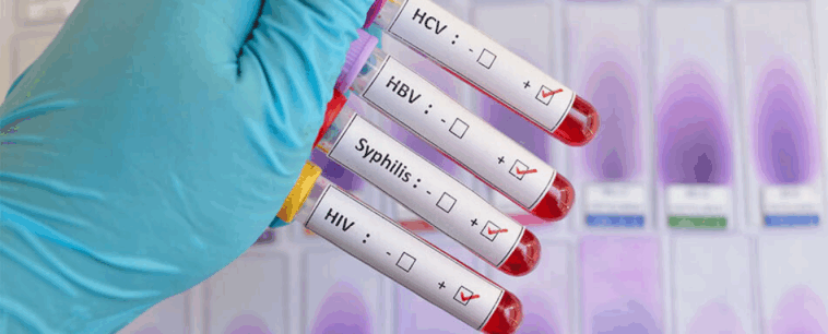 How to Prepare for an STD Test in Dubai 1 sss