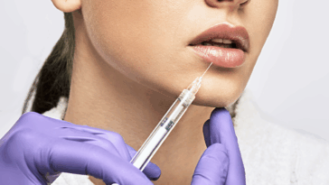 Look Younger Instantly Anti Aging Benefits of Lip Fillers