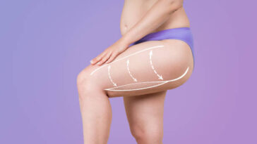 %D8%B4%D9%81%D8%B7 %D8%A7%D9%84%D8%AF%D9%87%D9%88%D9%86 %D9%81%D9%8A %D8%A7%D9%84%D8%B1%D9%8A%D8%A7%D8%B6 6