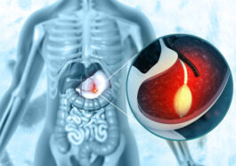 %D8%B9%D9%85%D9%84%D9%8A%D8%A9 %D8%A8%D8%A7%D9%84%D9%88%D9%86 %D8%A7%D9%84%D9%85%D8%B9%D8%AF%D8%A9 %D9%81%D9%8A %D8%A7%D9%84%D8%B1%D9%8A%D8%A7%D8%B6 8