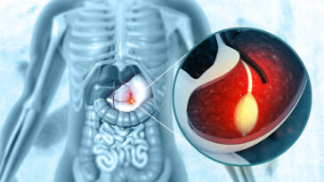 %D8%B9%D9%85%D9%84%D9%8A%D8%A9 %D8%A8%D8%A7%D9%84%D9%88%D9%86 %D8%A7%D9%84%D9%85%D8%B9%D8%AF%D8%A9 %D9%81%D9%8A %D8%A7%D9%84%D8%B1%D9%8A%D8%A7%D8%B6 8