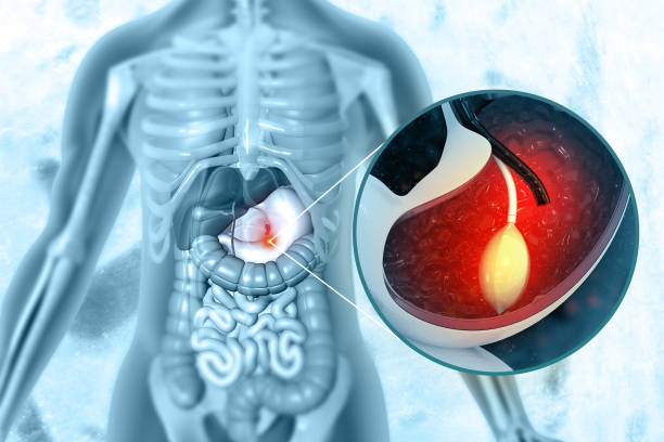 %D8%B9%D9%85%D9%84%D9%8A%D8%A9 %D8%A8%D8%A7%D9%84%D9%88%D9%86 %D8%A7%D9%84%D9%85%D8%B9%D8%AF%D8%A9 %D9%81%D9%8A %D8%A7%D9%84%D8%B1%D9%8A%D8%A7%D8%B6 8