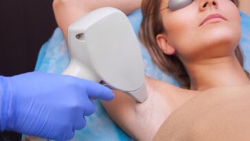 Is Laser Hair Removal in Dubai Safe for Darker Skin Tones