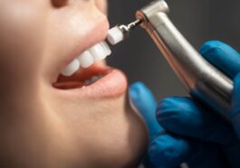 Shine bright with a thorough teeth cleaning