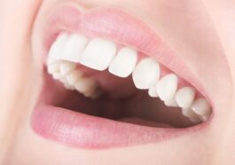 Scaling removes plaque to maintain oral health