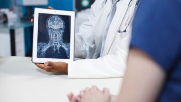 brain scan analysis by medical expert 482257 85714 1