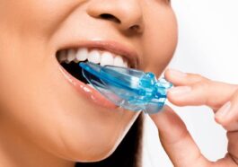 Teeth Sport Guard in Riyadh 24