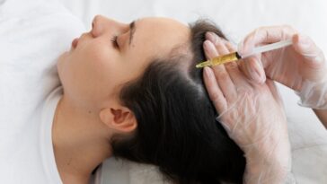 PRP Injections For Hair Loss What You