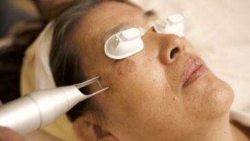 pico laser clinical whitening 768x512 1