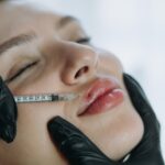 precision lip enhancement professional injectable treatment progress 476952 5018