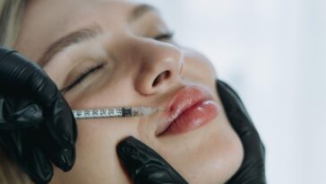 precision lip enhancement professional injectable treatment progress 476952 5018