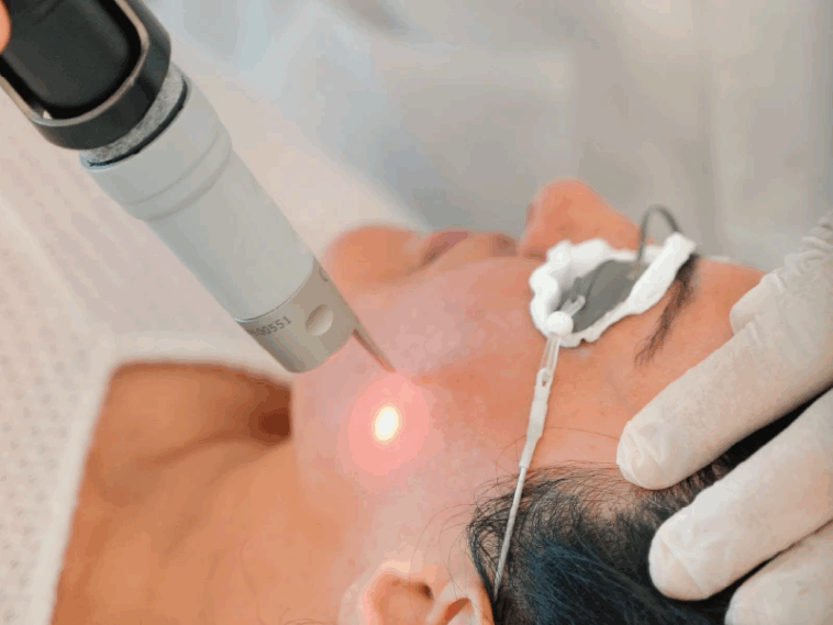 PicoSure Laser Treatment: Modern Solution for Ageing, Spots, Scars 1 Picosure Laser 800