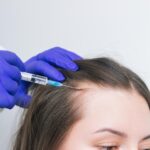 young brunette woman suffering hair loss receiving injections into scalp hair growth 753567 369