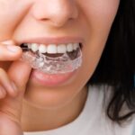 smiling woman with perfect healthy teeth using removable braces 177415 1057