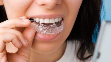 smiling woman with perfect healthy teeth using removable braces 177415 1057